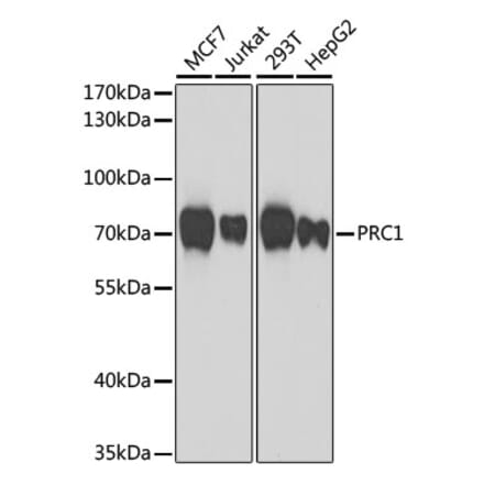 Western Blot - Anti-PRC1 Antibody (A10047) - Antibodies.com