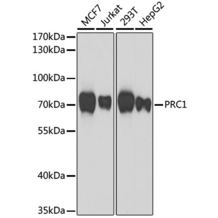 Western Blot - Anti-PRC1 Antibody (A10047) - Antibodies.com