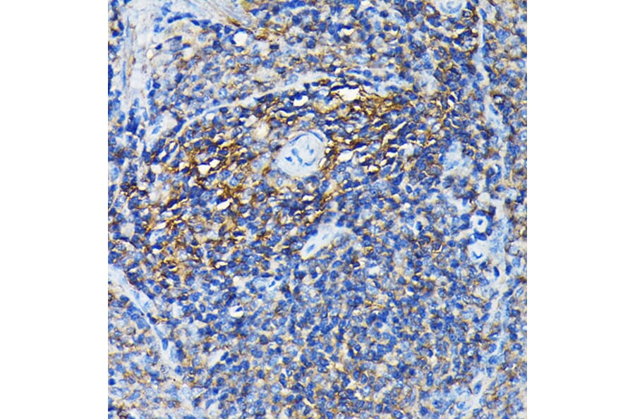 Immunohistochemistry - Anti-PRC1 Antibody (A10047) - Antibodies.com