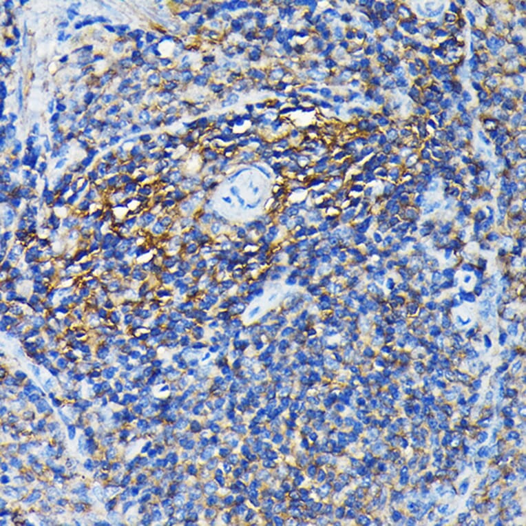 Immunohistochemistry - Anti-PRC1 Antibody (A10047) - Antibodies.com