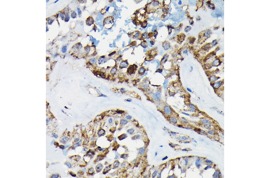 Immunohistochemistry - Anti-PRC1 Antibody (A10047) - Antibodies.com