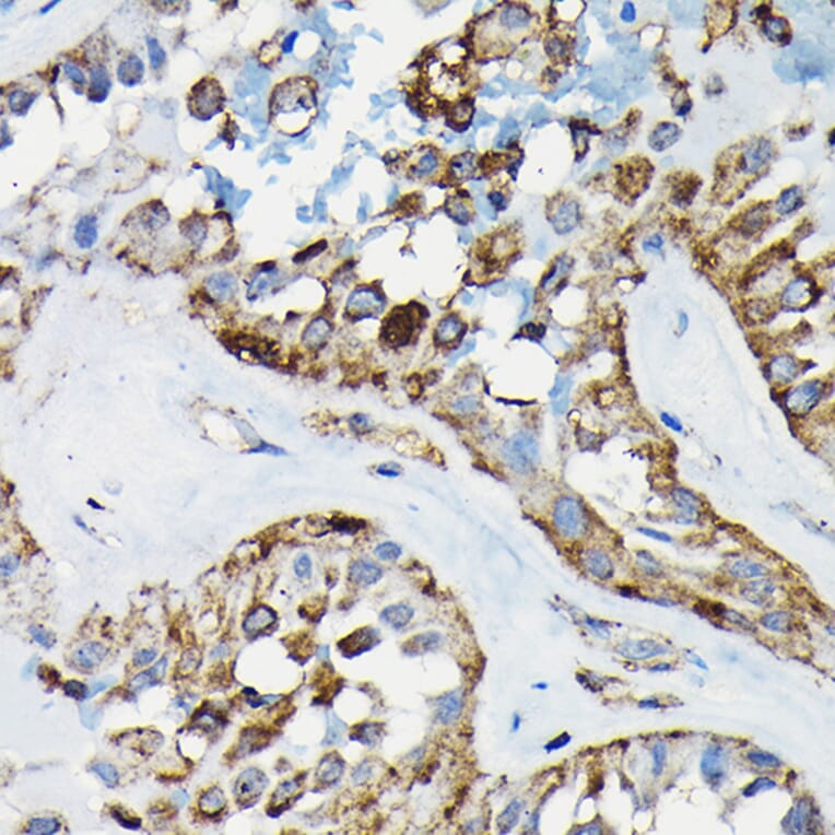 Immunohistochemistry - Anti-PRC1 Antibody (A10047) - Antibodies.com