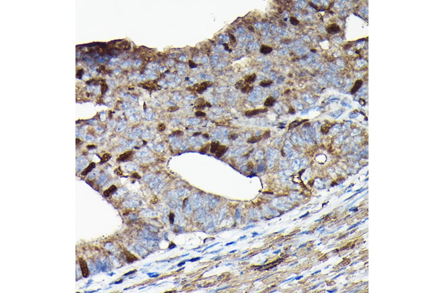 Immunohistochemistry - Anti-PRC1 Antibody (A10047) - Antibodies.com