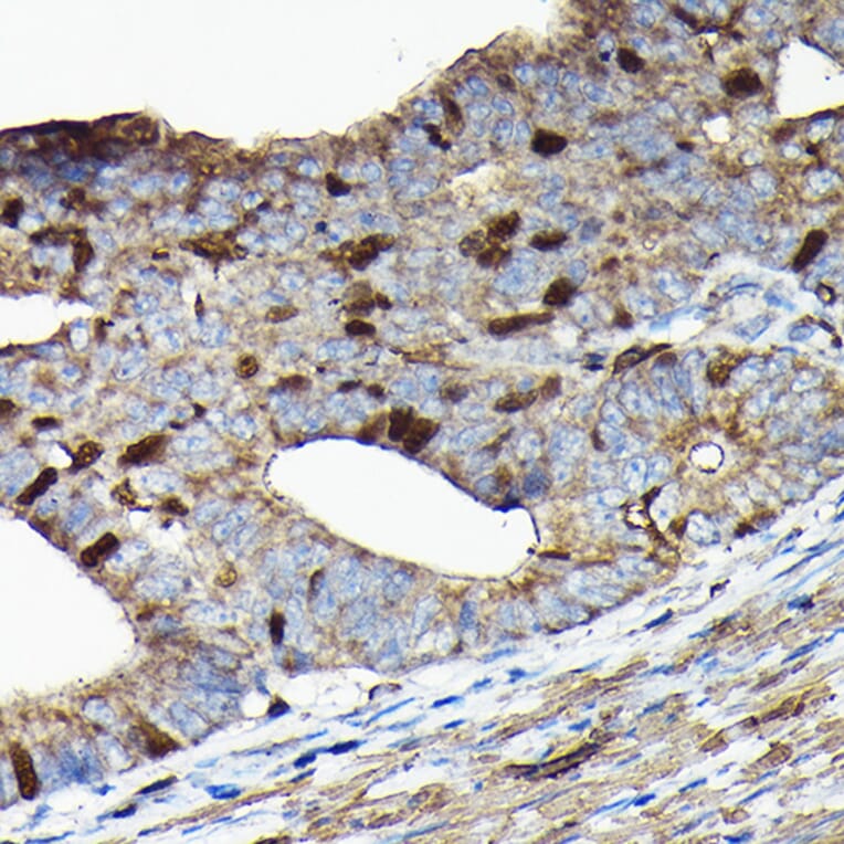 Immunohistochemistry - Anti-PRC1 Antibody (A10047) - Antibodies.com