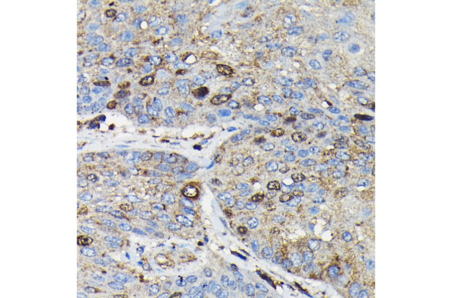 Immunohistochemistry - Anti-PRC1 Antibody (A10047) - Antibodies.com