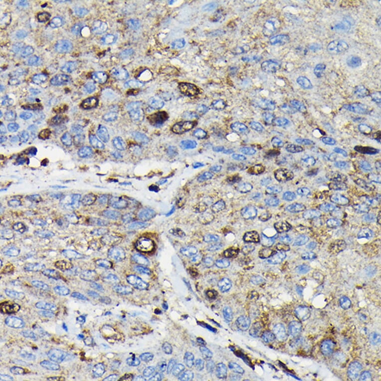 Immunohistochemistry - Anti-PRC1 Antibody (A10047) - Antibodies.com