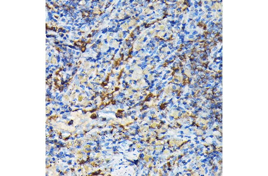 Immunohistochemistry - Anti-PRC1 Antibody (A10047) - Antibodies.com