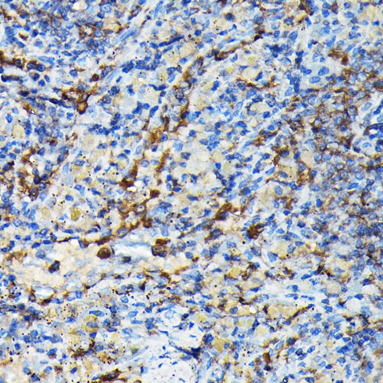 Immunohistochemistry - Anti-PRC1 Antibody (A10047) - Antibodies.com