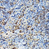 Immunohistochemistry - Anti-PRC1 Antibody (A10047) - Antibodies.com