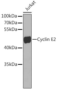 Western blot analysis of extracts of Jurkat cells, using Anti-CCNE2 Antibody (A7032).
Secondary antibody: Goat Anti-Rabbit IgG (H+L) (HRP) (AS014) at 1:10,000 dilution.
Lysates / proteins: 25µg per lane.
Blocking buffer: 3% non-fat dry milk in TBST.
