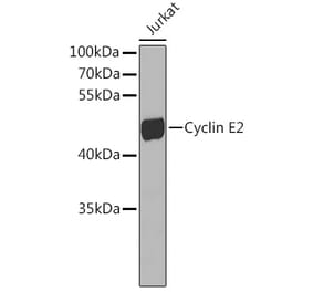 Western Blot - Anti-Cyclin E2 Antibody (A10048) - Antibodies.com