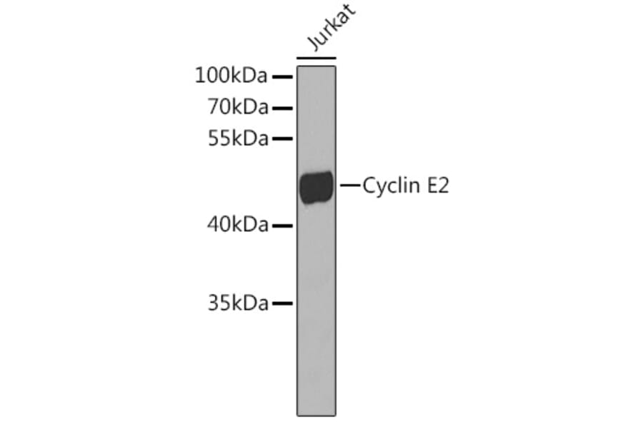 Western Blot - Anti-Cyclin E2 Antibody (A10048) - Antibodies.com