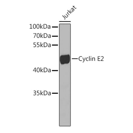 Western Blot - Anti-Cyclin E2 Antibody (A10048) - Antibodies.com