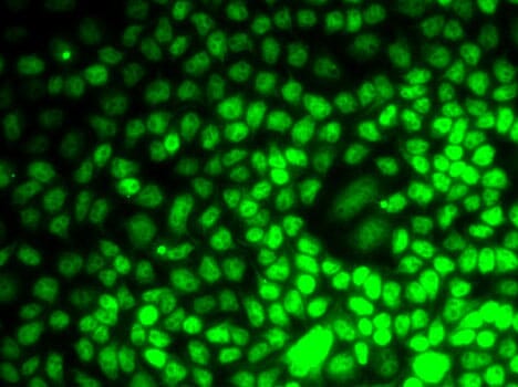 Immunofluorescence analysis of MCF7 cells using Anti-CCNE2 Antibody (A7032).