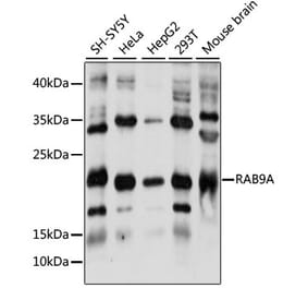 Western Blot - Anti-Rab9 Antibody (A10049) - Antibodies.com
