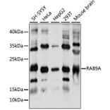 Western Blot - Anti-Rab9 Antibody (A10049) - Antibodies.com