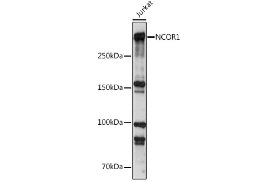 Western Blot - Anti-Nuclear Receptor Corepressor NCoR Antibody (A10050) - Antibodies.com