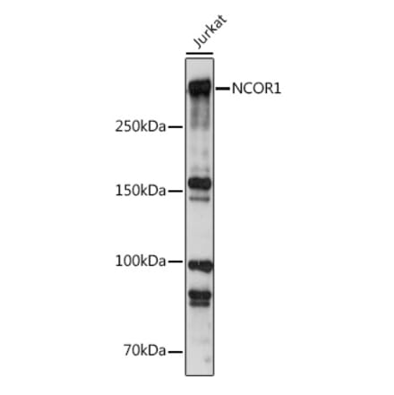 Western Blot - Anti-Nuclear Receptor Corepressor NCoR Antibody (A10050) - Antibodies.com