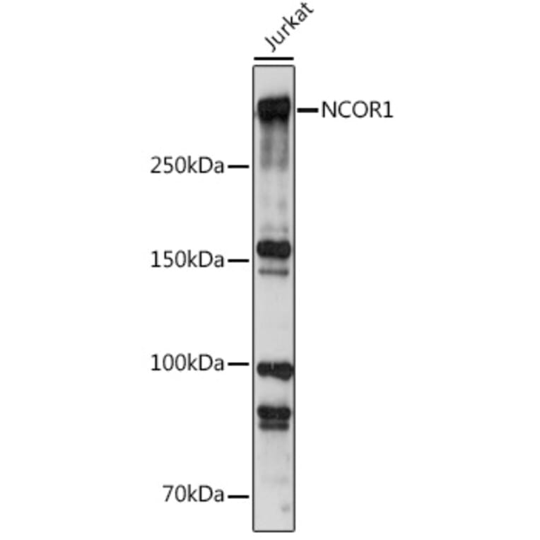 Western Blot - Anti-Nuclear Receptor Corepressor NCoR Antibody (A10050) - Antibodies.com