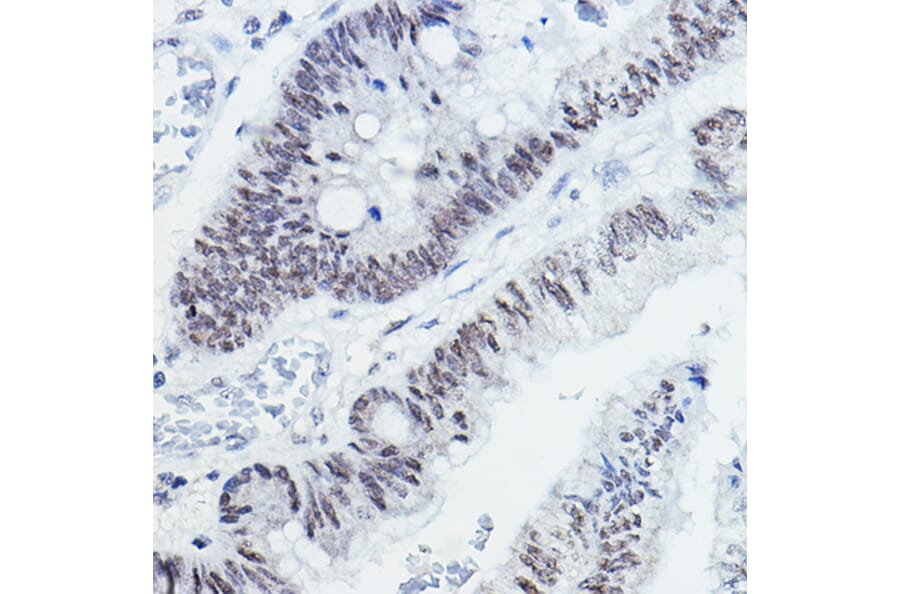 Immunohistochemistry - Anti-Nuclear Receptor Corepressor NCoR Antibody (A10050) - Antibodies.com