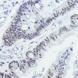 Immunohistochemistry - Anti-Nuclear Receptor Corepressor NCoR Antibody (A10050) - Antibodies.com