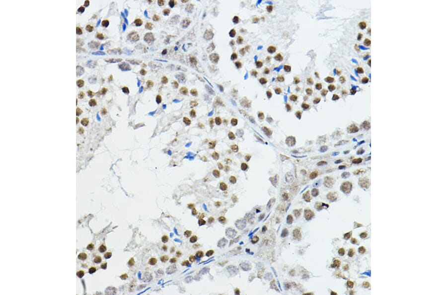 Immunohistochemistry - Anti-Nuclear Receptor Corepressor NCoR Antibody (A10050) - Antibodies.com