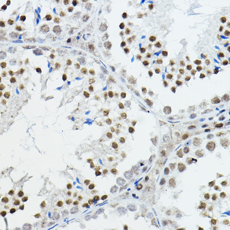 Immunohistochemistry - Anti-Nuclear Receptor Corepressor NCoR Antibody (A10050) - Antibodies.com