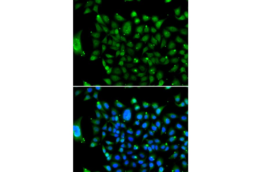 Immunofluorescence - Anti-Nuclear Receptor Corepressor NCoR Antibody (A10050) - Antibodies.com