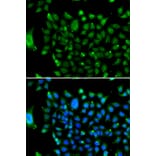 Immunofluorescence - Anti-Nuclear Receptor Corepressor NCoR Antibody (A10050) - Antibodies.com