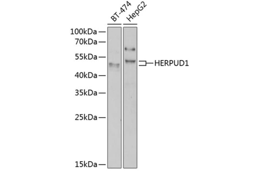 Western Blot - Anti-HERPUD1 Antibody (A7048) - Antibodies.com