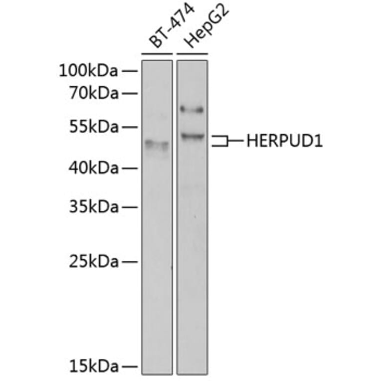 Western Blot - Anti-HERPUD1 Antibody (A7048) - Antibodies.com