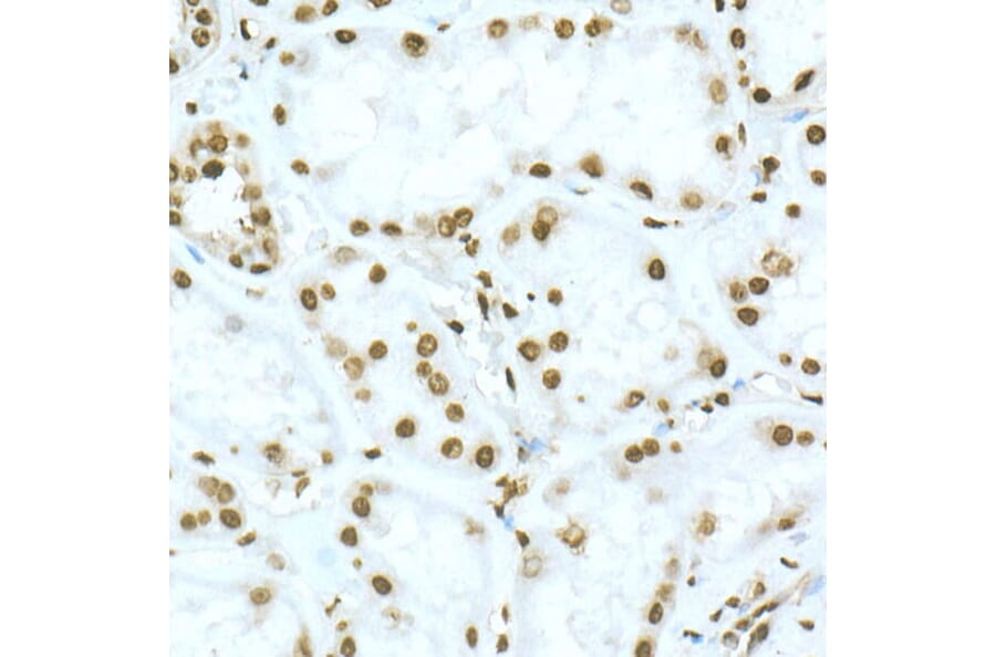 Immunohistochemistry - Anti-TOX Antibody (A10052) - Antibodies.com