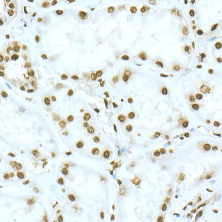 Immunohistochemistry - Anti-TOX Antibody (A10052) - Antibodies.com