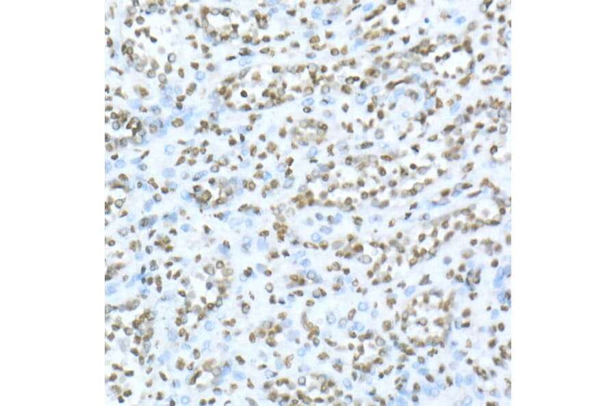 Immunohistochemistry - Anti-TOX Antibody (A10052) - Antibodies.com