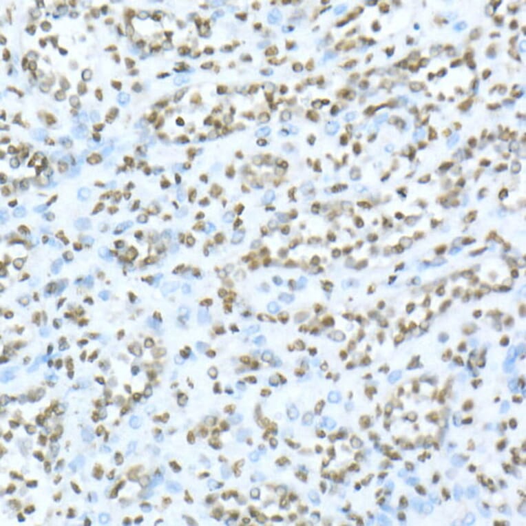 Immunohistochemistry - Anti-TOX Antibody (A10052) - Antibodies.com