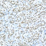 Immunohistochemistry - Anti-TOX Antibody (A10052) - Antibodies.com