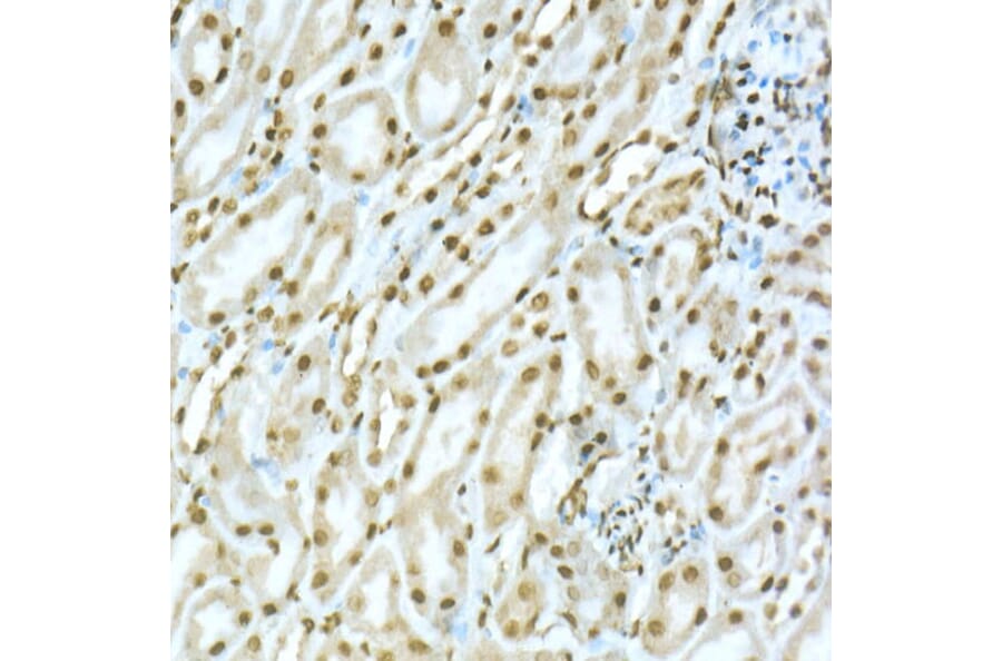 Immunohistochemistry - Anti-TOX Antibody (A10052) - Antibodies.com