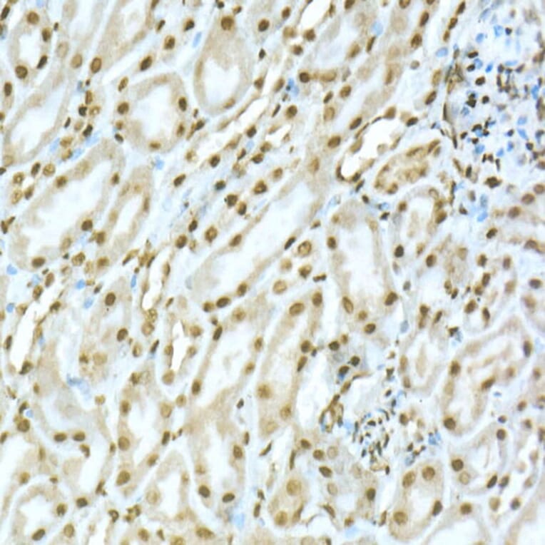 Immunohistochemistry - Anti-TOX Antibody (A10052) - Antibodies.com