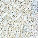 Immunohistochemistry - Anti-TOX Antibody (A10052) - Antibodies.com