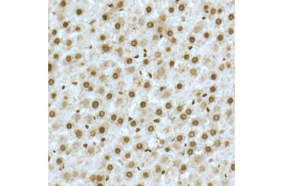 Immunohistochemistry - Anti-TOX Antibody (A10052) - Antibodies.com