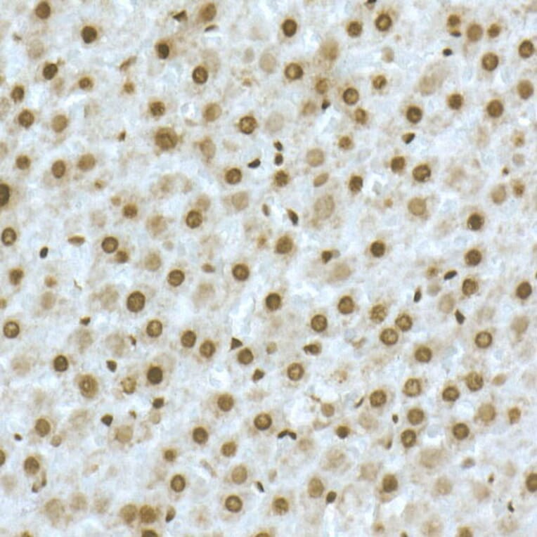 Immunohistochemistry - Anti-TOX Antibody (A10052) - Antibodies.com