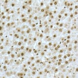Immunohistochemistry - Anti-TOX Antibody (A10052) - Antibodies.com