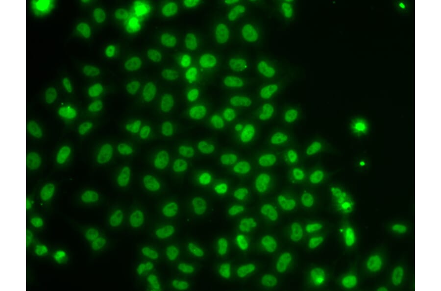 Immunofluorescence - Anti-TOX Antibody (A10052) - Antibodies.com