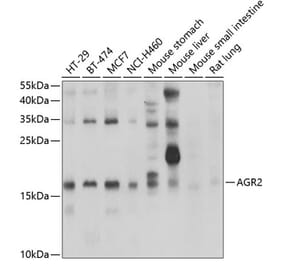 Western Blot - Anti-AGR2 Antibody (A10053) - Antibodies.com