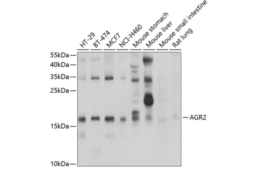 Western Blot - Anti-AGR2 Antibody (A10053) - Antibodies.com