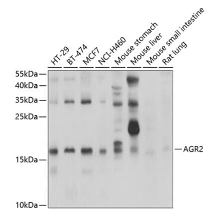 Western Blot - Anti-AGR2 Antibody (A10053) - Antibodies.com