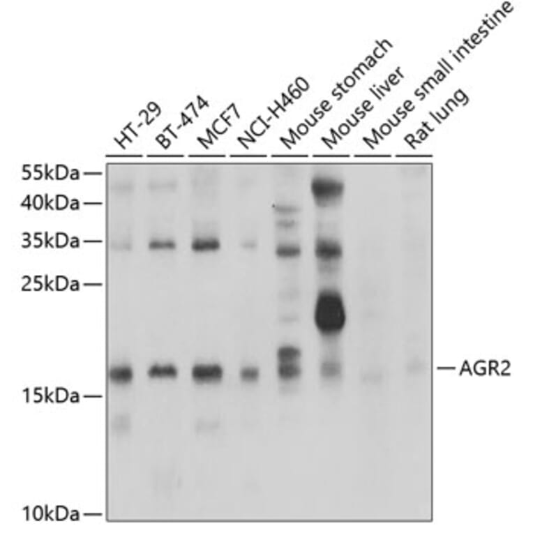 Western Blot - Anti-AGR2 Antibody (A10053) - Antibodies.com