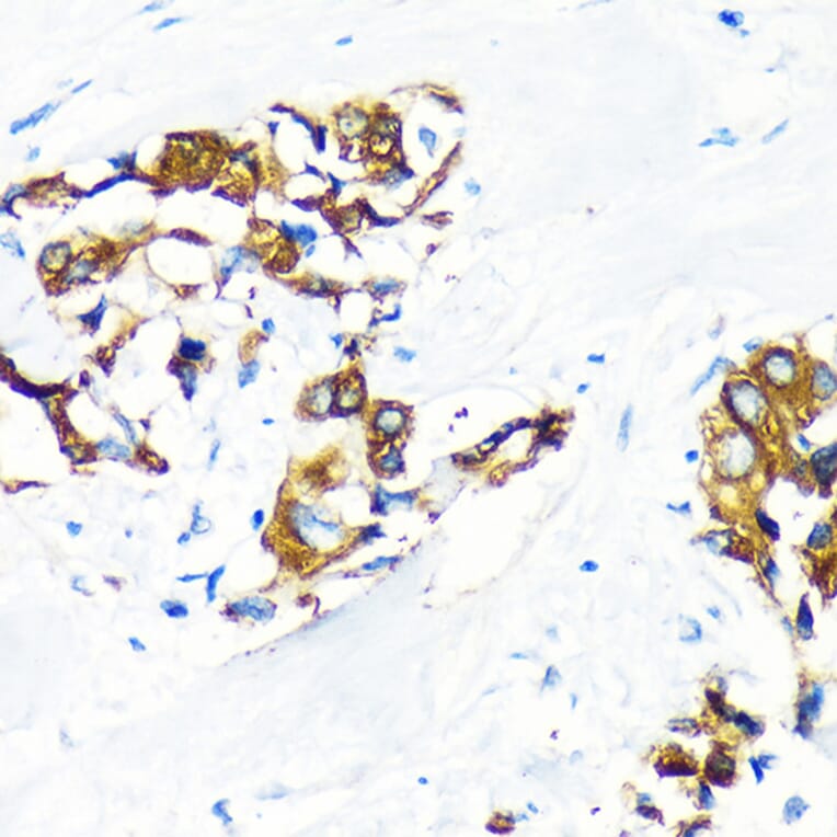 Immunohistochemistry - Anti-AGR2 Antibody (A10053) - Antibodies.com