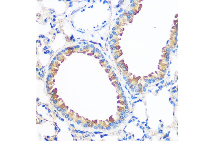 Immunohistochemistry - Anti-AGR2 Antibody (A10053) - Antibodies.com