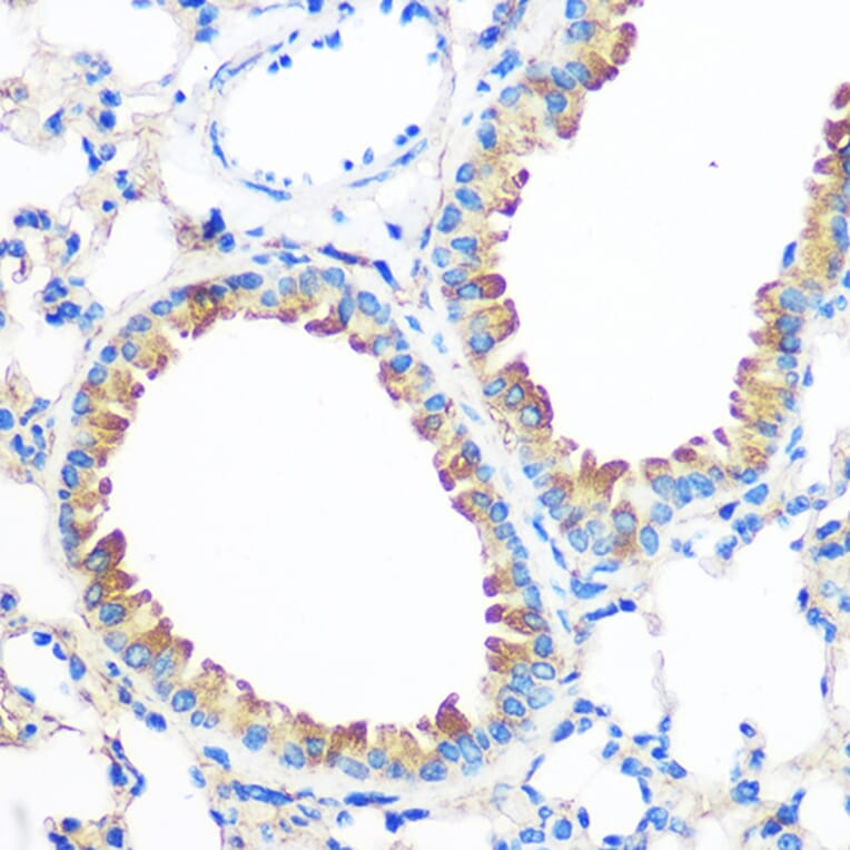 Immunohistochemistry - Anti-AGR2 Antibody (A10053) - Antibodies.com